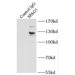Sperm Associated Antigen 5 (SPAG5) Antibody