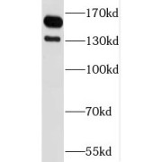 WB analysis of HeLa cells, using SPAG5 antibody (1/1000 dilution).
