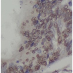 Sperm-Associated Antigen 7 (SPAG7) Antibody