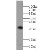 WB analysis of DU 145 cells, using SPANXA2 antibody (1/500 dilution).