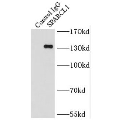 SPARC Like Protein 1 (SPARCL1) Antibody