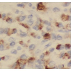 Spartin, SPG20 Antibody