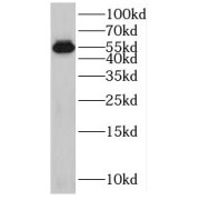 WB analysis of mouse testis tissue, using SPATA6 antibody (1/800 dilution).