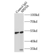 IP analysis of mouse testis tissue lysate (4000 µg), using SPDYA antibody (3 µg, detection: 1/300 dilution).