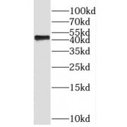 WB analysis of L02 cells, using SPHK1-Phospho-Ser225 antibody (1/500 dilution).