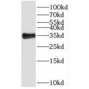WB analysis of mouse liver tissue, using SPI1 antibody (1/300 dilution).