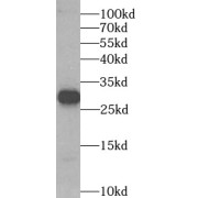 WB analysis of HeLa cells, using SPIN1 antibody (1/1000 dilution).