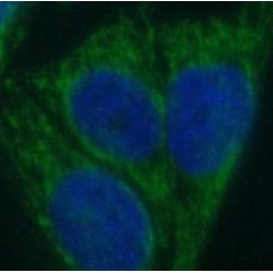 Small Proline Rich Protein 3 (SPRR3) Antibody