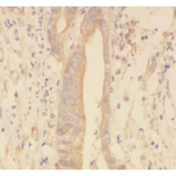 Small Proline Rich Protein 3 (SPRR3) Antibody