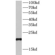 WB analysis of HeLa cells, using SPRR3 antibody (1/1000 dilution).