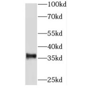 WB analysis of Jurkat cells, using SPRYD5 antibody (1/300 dilution).