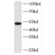 WB analysis of PC-3 cells, using SPZ1 antibody (1/1000 dilution).