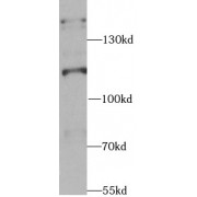 WB analysis of HeLa cells, using SR140 antibody (1/1000 dilution).