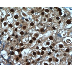 Steroid Receptor RNA Activator 1 (SRA1) Antibody