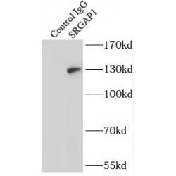 SLIT-ROBO Rho GTPase Activating Protein 1 (SRGAP1) Antibody