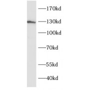 WB analysis of mouse brain tissue, using SRGAP1 antibody (1/800 dilution).