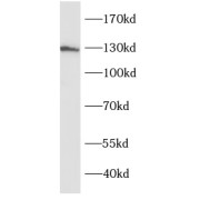 WB analysis of mouse brain tissue, using SRGAP1 antibody (1/800 dilution).