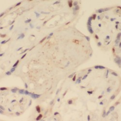 Sushi Repeat-Containing Protein SRPX2 (SRPX2) Antibody