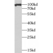 WB analysis of HeLa cells, using SSRP1 antibody (1/1000 dilution).