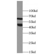 WB analysis of L02 cells, using SSTR1 antibody (1/1000 dilution).
