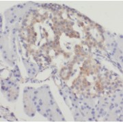 abx238254