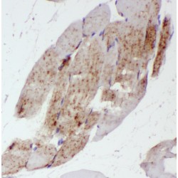 ST3 Beta-Galactoside Alpha-2,3-Sialyltransferase 5 (ST3GAL5) Antibody