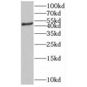 WB analysis of HEK-293 cells, using ST3GAL5 antibody (1/500 dilution).