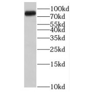 WB analysis of human testis tissue, using ST5 antibody (1/500 dilution).