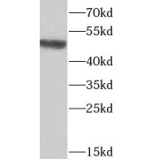WB analysis of mouse lung tissue, using ST6GAL1 antibody (1/1000 dilution).