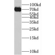 WB analysis of Jurkat cells, using STAM antibody (1/1500 dilution).