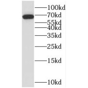 WB analysis of mouse brain tissue, using STAM2 antibody (1/1000 dilution).