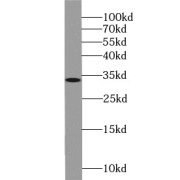WB analysis of HEK-293 cells, using STC2 antibody (1/1000 dilution).