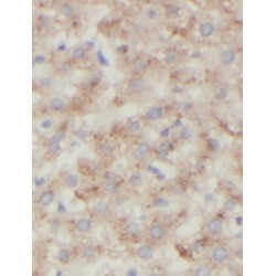 StAR-Related Lipid Transfer Protein 10 (STARD10) Antibody