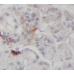 StAR Related Lipid Transfer Domain Containing 5 (STARD5) Antibody