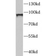 WB analysis of PC-3 cells, using STAT1 antibody (1/600 dilution).