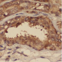 Signal Transducer And Activator of Transcription 2 (STAT2) Antibody