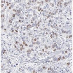 Signal Transducer And Activator of Transcription 2 (STAT2) Antibody