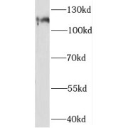 WB analysis of HeLa cells, using STAT2 antibody (1/500 dilution).