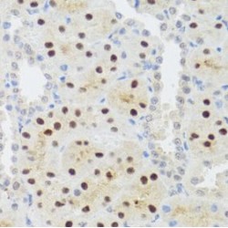 Signal Transducer And Activator of Transcription 4 (STAT4) Antibody
