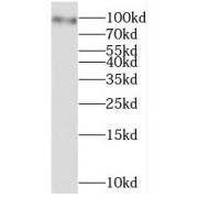 WB analysis of NIH/3T3 cells, using STAT5A antibody (1/400 dilution).