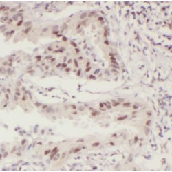 Signal Transducer And Activator of Transcription 5B (STAT5B) Antibody