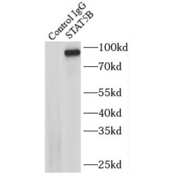 Signal Transducer And Activator of Transcription 5B (STAT5B) Antibody