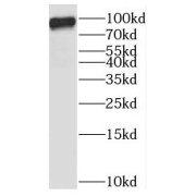 WB analysis of HeLa cells, using STAT5B antibody (1/1000 dilution).