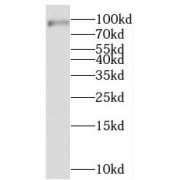 WB analysis of HeLa cells, using STAT5B antibody (1/1000 dilution).
