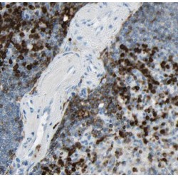 Signal Transducer And Activator of Transcription 6 (STAT6) Antibody