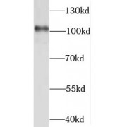WB analysis of NIH/3T3 cells, using STAT6 antibody (1/1500 dilution).