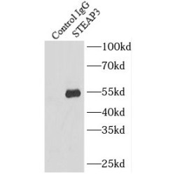 STEAP3 Metalloreductase (STEAP3) Antibody