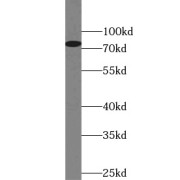 WB analysis of Jurkat cells, using STIM1 antibody (1/500 dilution).