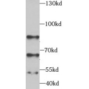 WB analysis of HeLa cells, using STK3 antibody (1/1000 dilution).