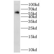 WB analysis of human heart tissue, using STK32C antibody (1/500 dilution).